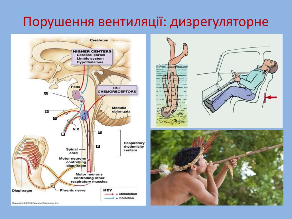 Порушення вентиляції: дизрегуляторне