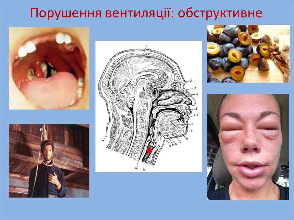 Патологія дихальної системи - презентация онлайн