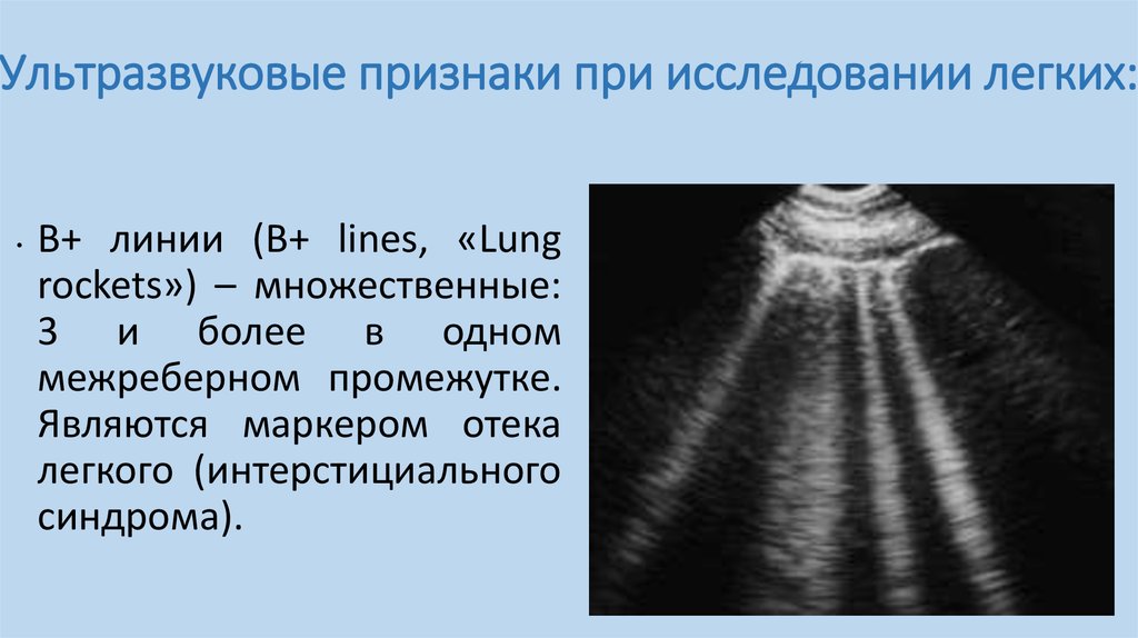 Изображение при узи получают