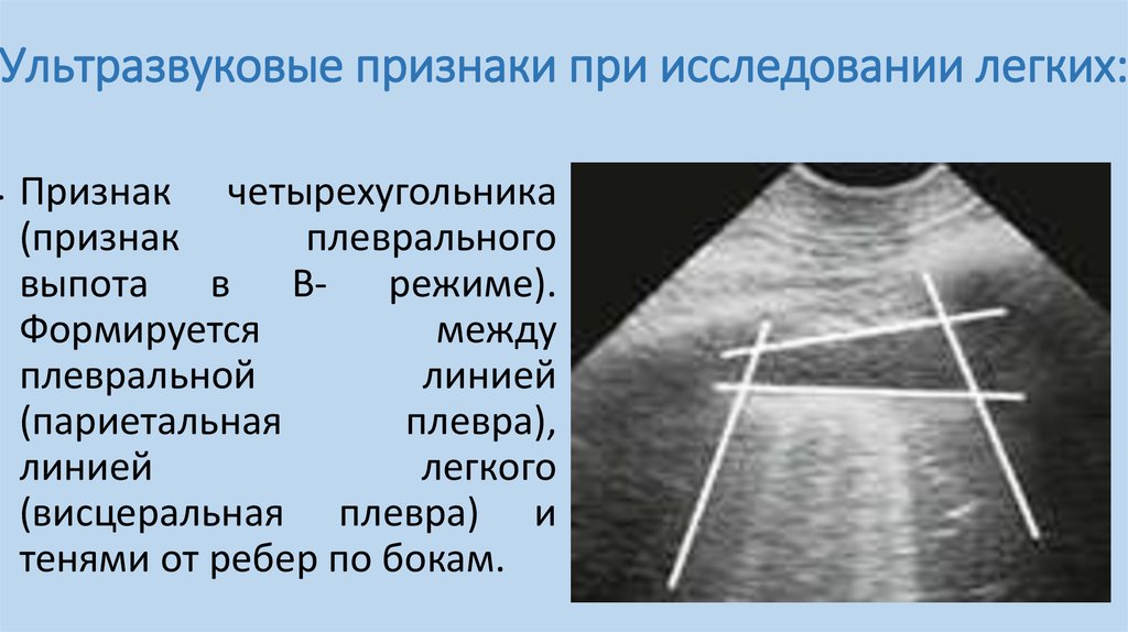 Узи легких протокол и плевры образец