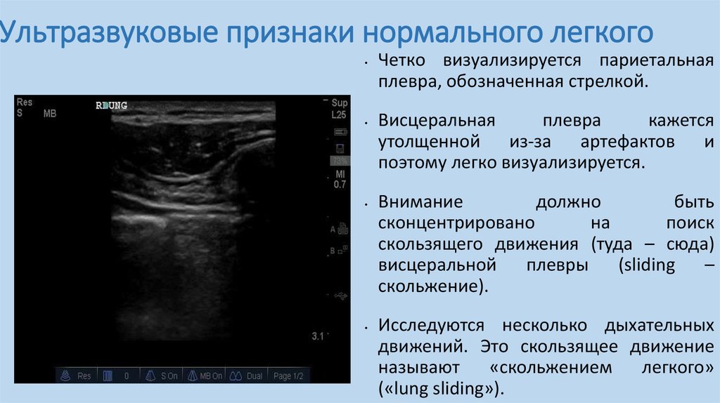 Узи легких протокол и плевры образец