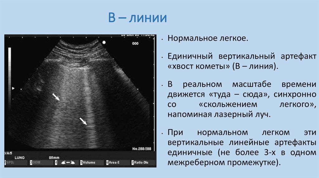 Хвост кометы на узи