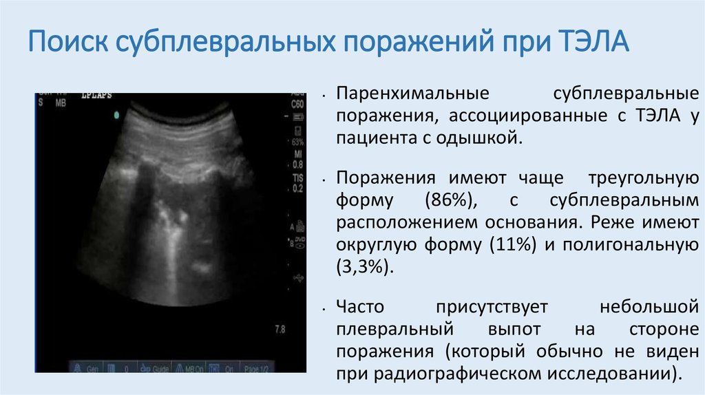 Узи плевральной полости. УЗИ легких заключение. Тэла заключение.