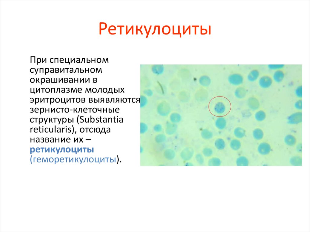 Ретикулоциты это. Ретикулоциты суправитальная окраска. Ретикулоциты – 3%,. Суправитальное окрашивание ретикулоцитов. Ретикулоциты функции.