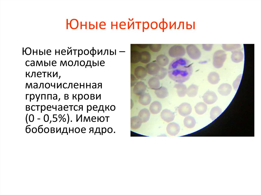 Сегмента ядерная. Юный нейтрофил гистология. Юный нейтрофил под микроскопом. Молодые незрелые нейтрофилы. Палочкоядерные нейтрофилы размер клетки.