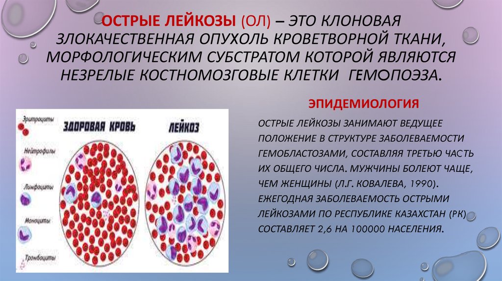 Лейкоз картинки для презентации