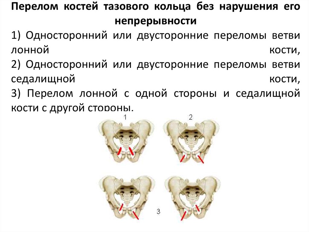 Кости таза сколько