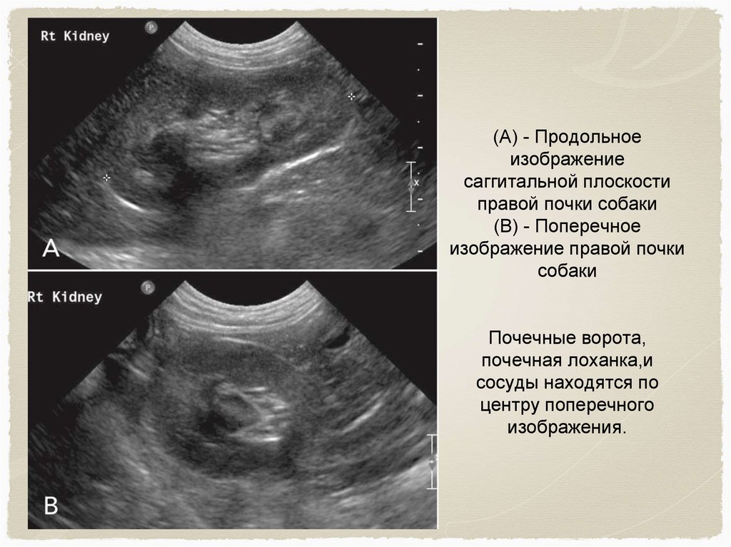 Презентация на тему узи