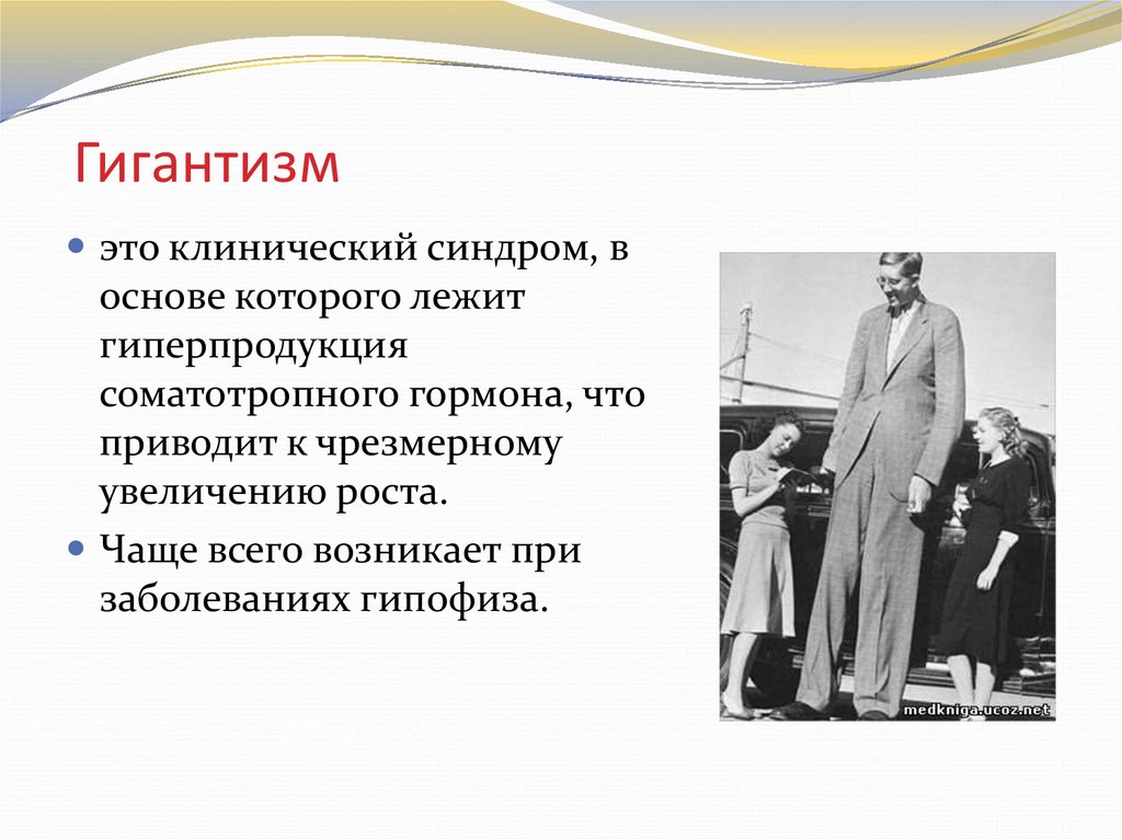 Заболевания связанные с ростом. Заболевание гигантизм. Клинические проявления гигантизма. Заболевания эндокринной системы гигантизм.