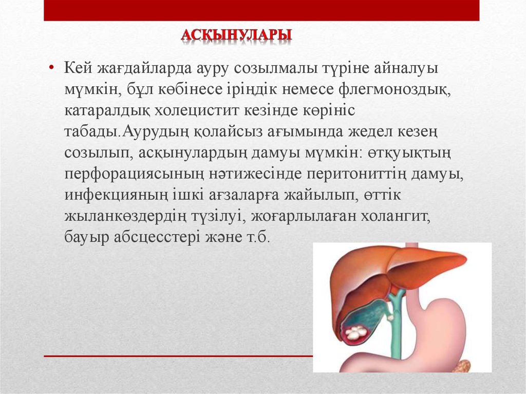 Созылмалы холецистит презентация