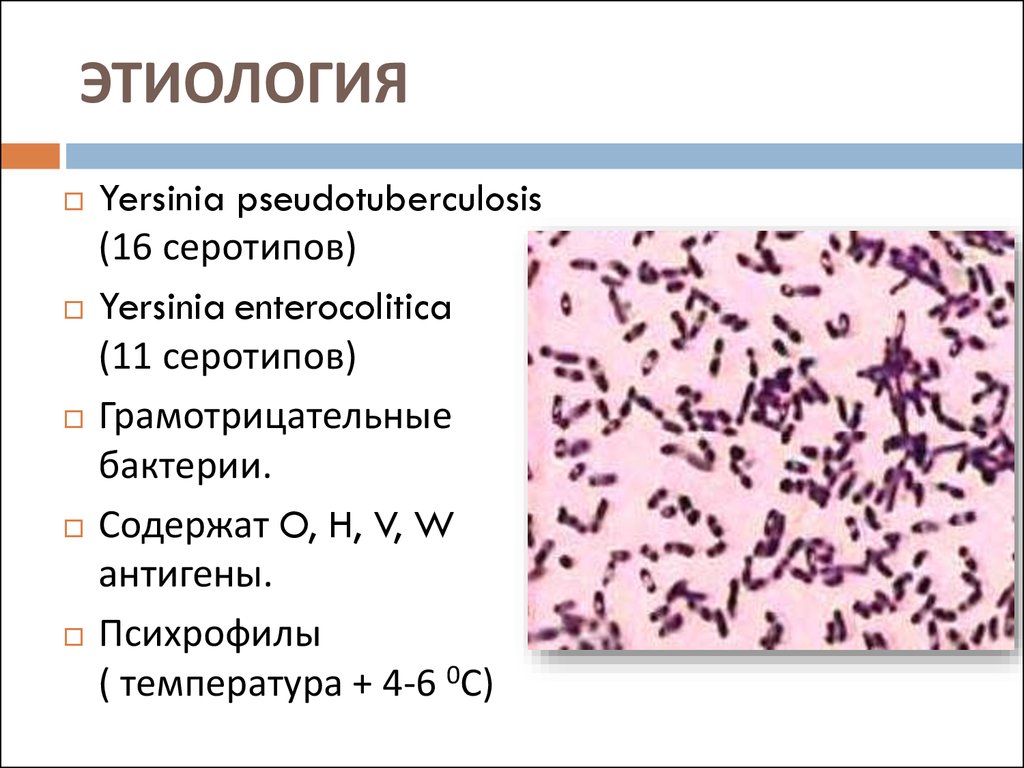 Дифференциация возбудителей. Yersinia enterocolitica микробиология. Yersinia enterocolitica микроскопия. Yersinia pseudotuberculosis. Yersinia enterocolitica таксономия.