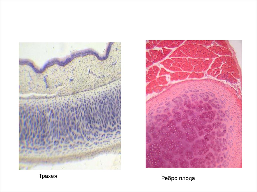 Ткань плода. Гиалиновая хрящевая ткань трахеи. Гиалиновая хрящевая ткань ребра. Гиалиновый хрящ ребра плода. Хрящ ребра гистология.