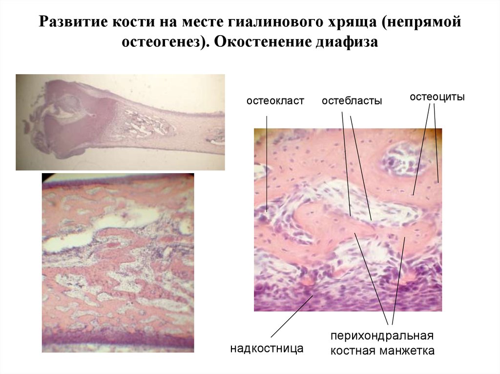 Схема непрямого остеогенеза гистология