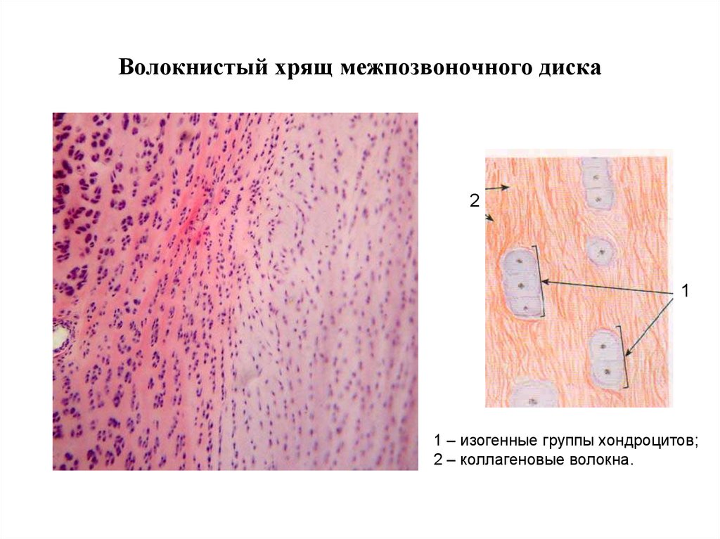 Волокнистый хрящ рисунок