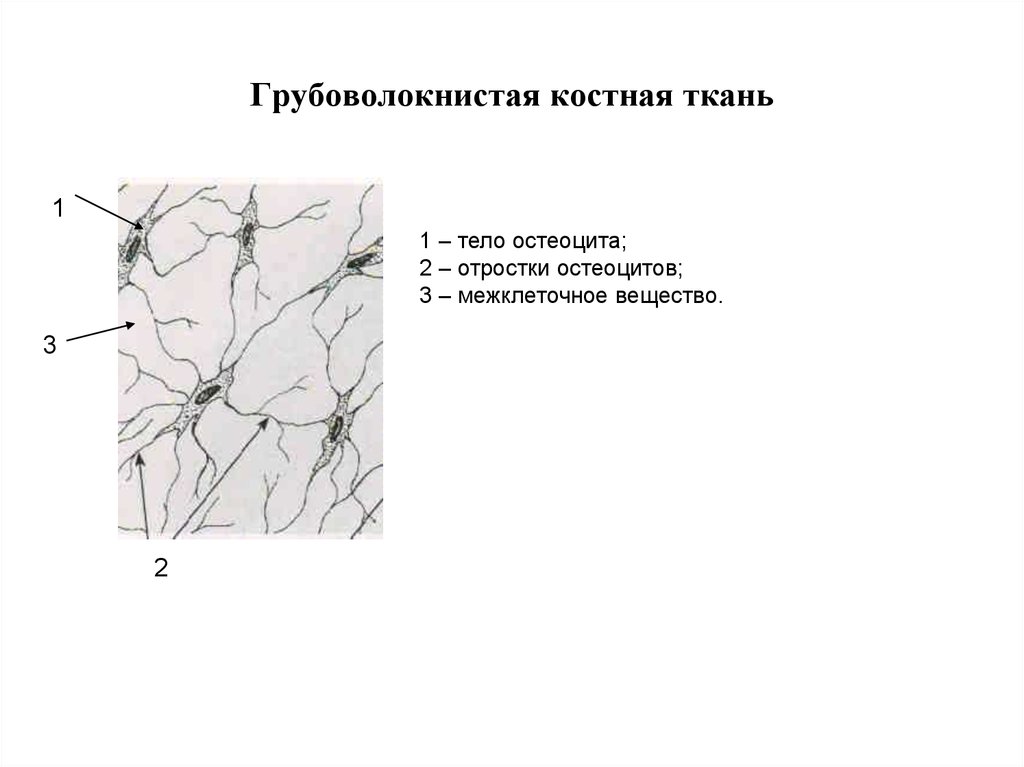 Соединительная костная. Грубоволокнистая костная ткань рисунок. Грубоволокнистая костная ткань препарат. Грубоволокнистая ткань строение. 45. Грубоволокнистая ткань. Костные клетки жаберной крышки селедки..