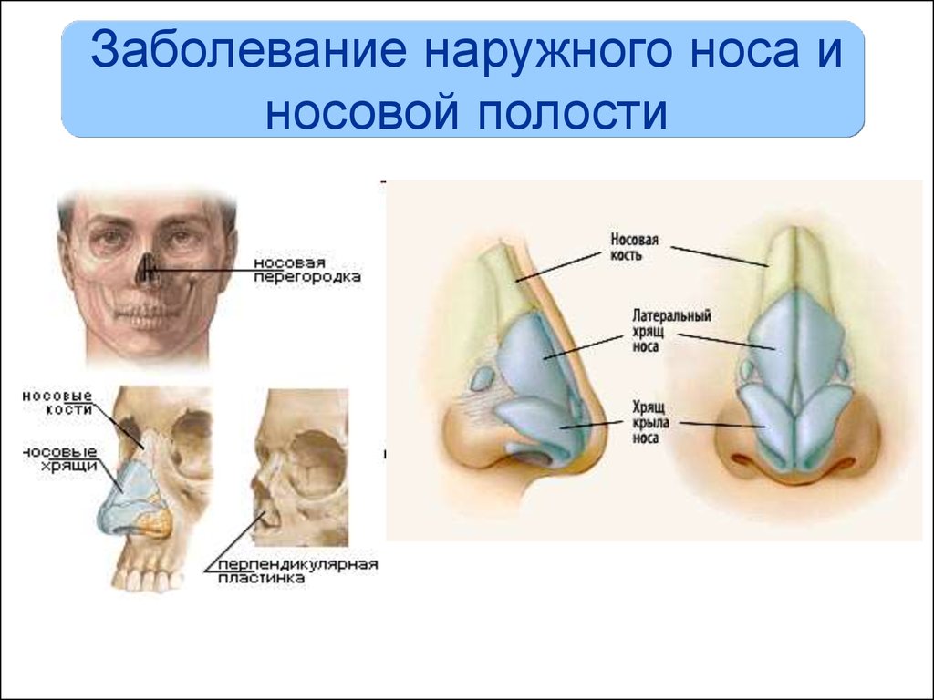 Болезни носа. Заболевания наружного носа. Заболевания наружного носа и носовой полости. Патология наружного носа.