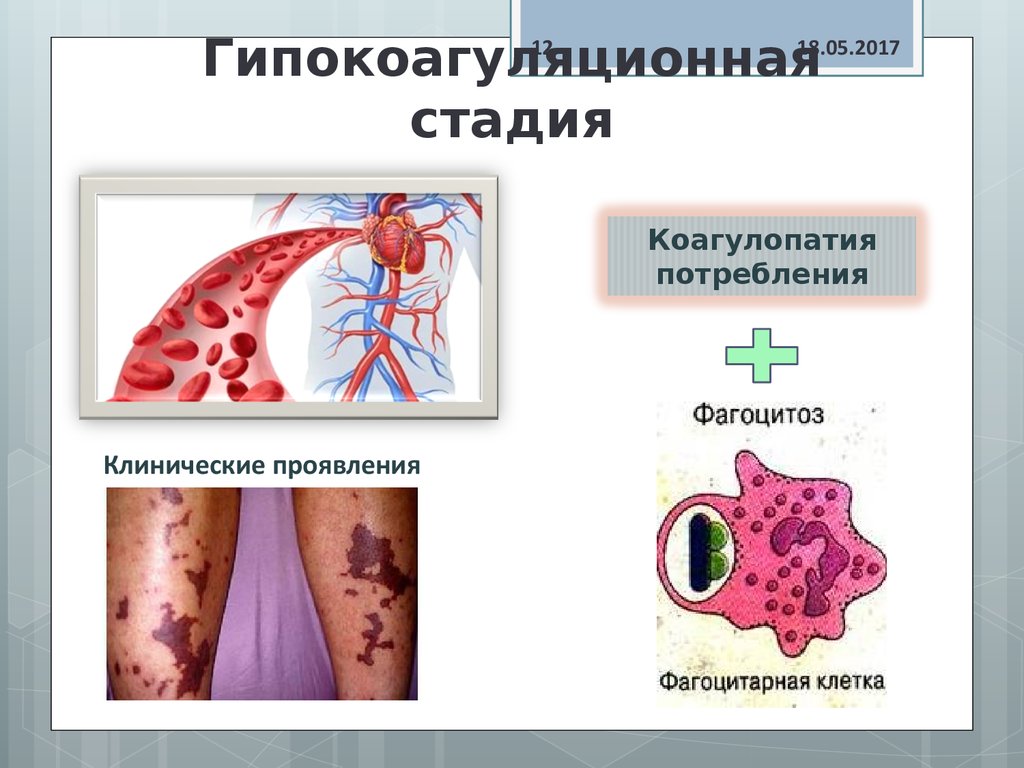 В схемах лечения двс синдрома присутствуют