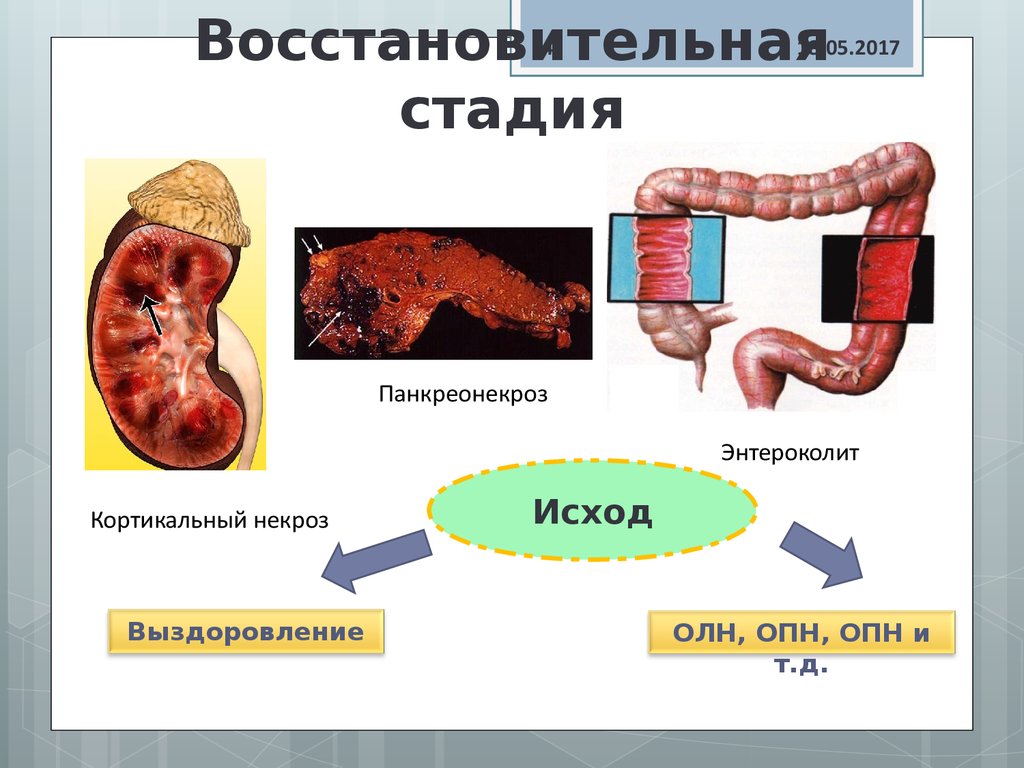 Восстановительная стадия