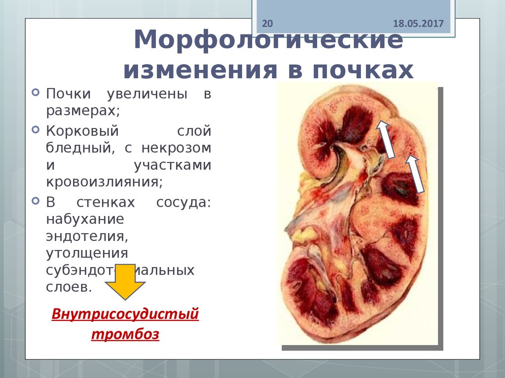 В схемах лечения двс синдрома присутствуют