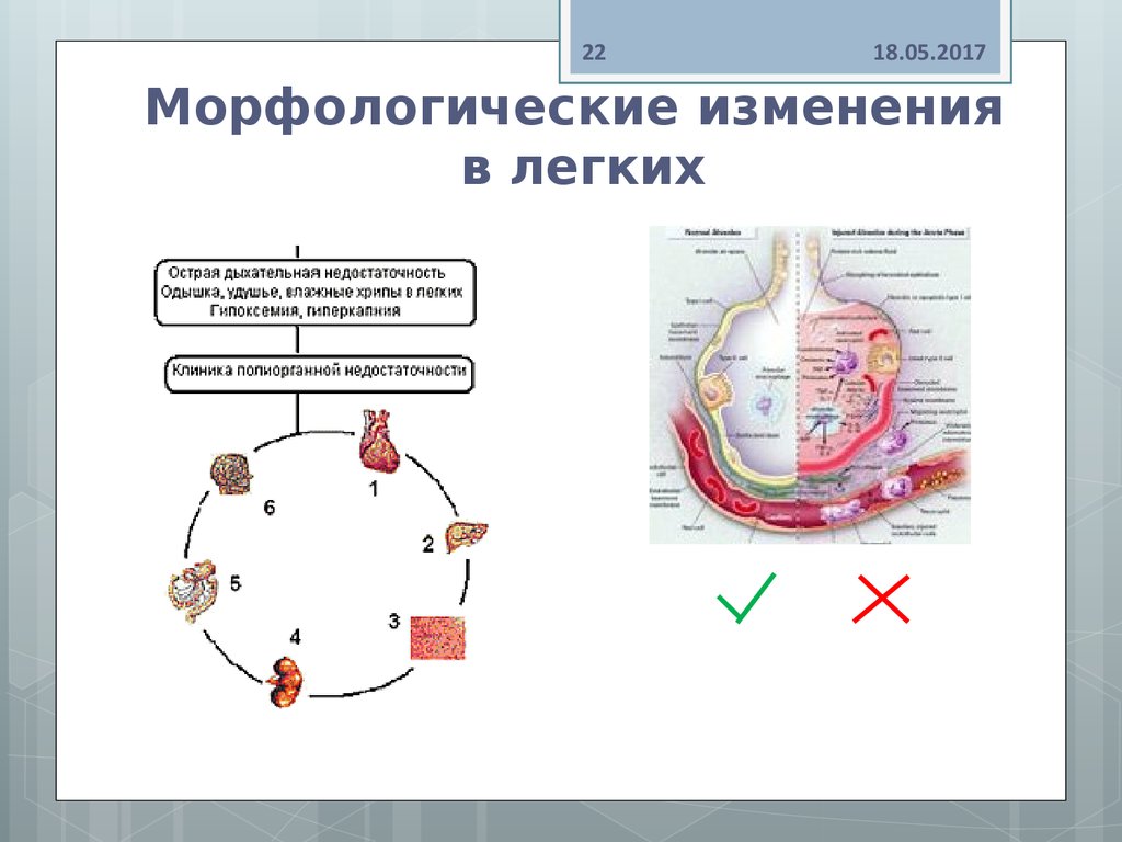 Морфологические изменения в легких