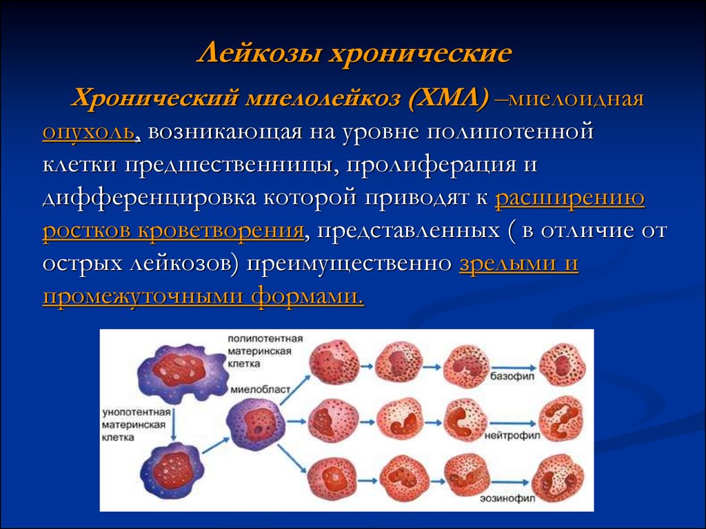 Острый и хронический лейкоз презентация