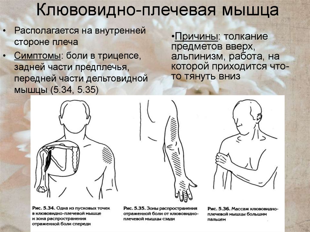Клювовидно-плечевая мышца