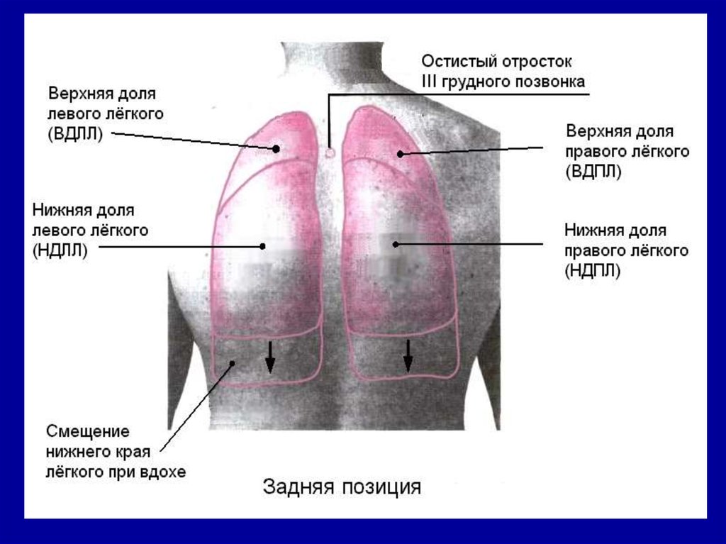 Верхняя правая. Нижняя доля легкого сзади. Нижняя доля правого легкого. Верхняя доля левого лёгкого. Нижняя доля левого легкого.