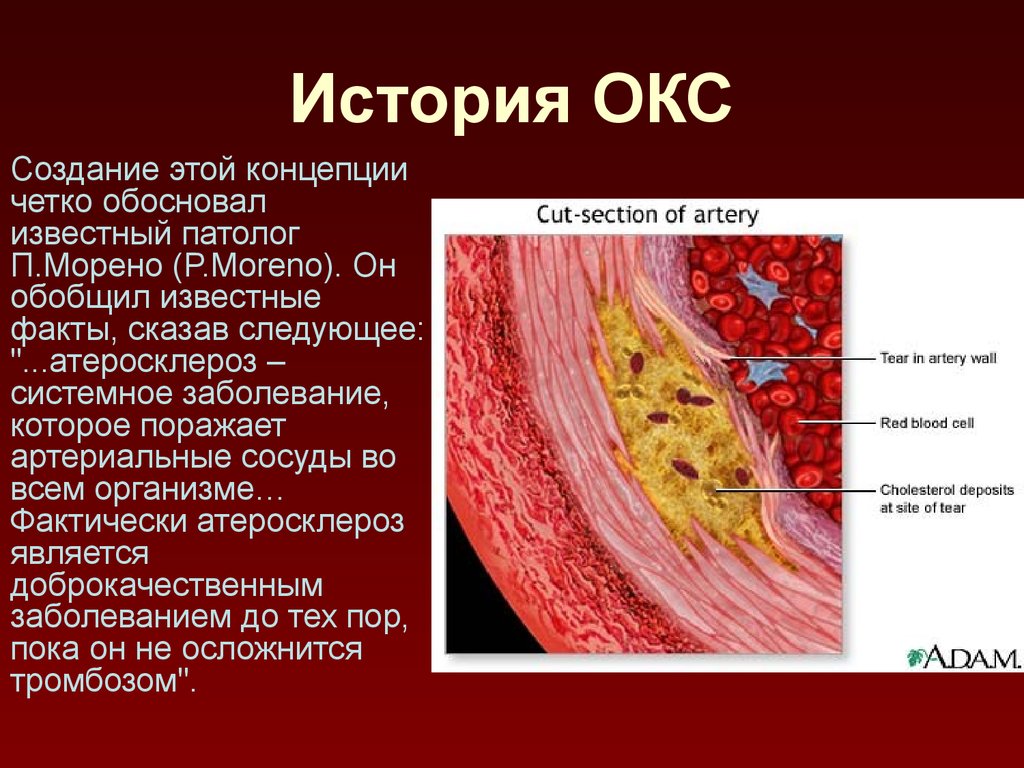 Окс история