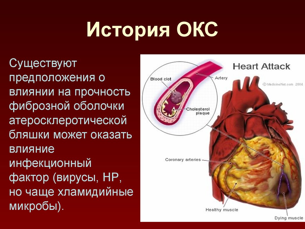 Окс картинки для презентации