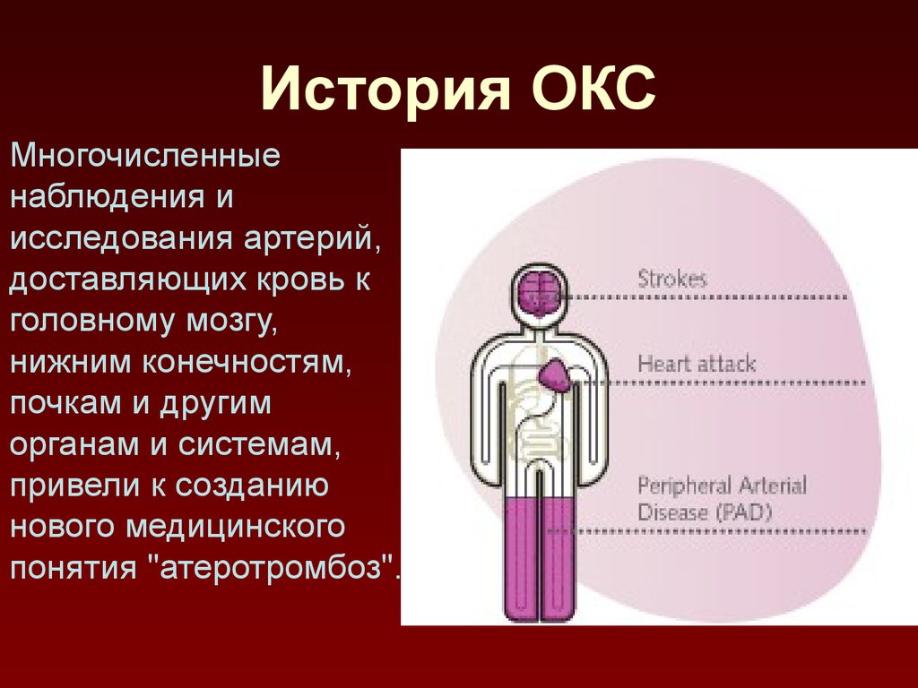 Окс история. Катар это в медицине термин. Как называется сосуд доставляющий кровь в мозг. Картинки ИНМТ краткий.