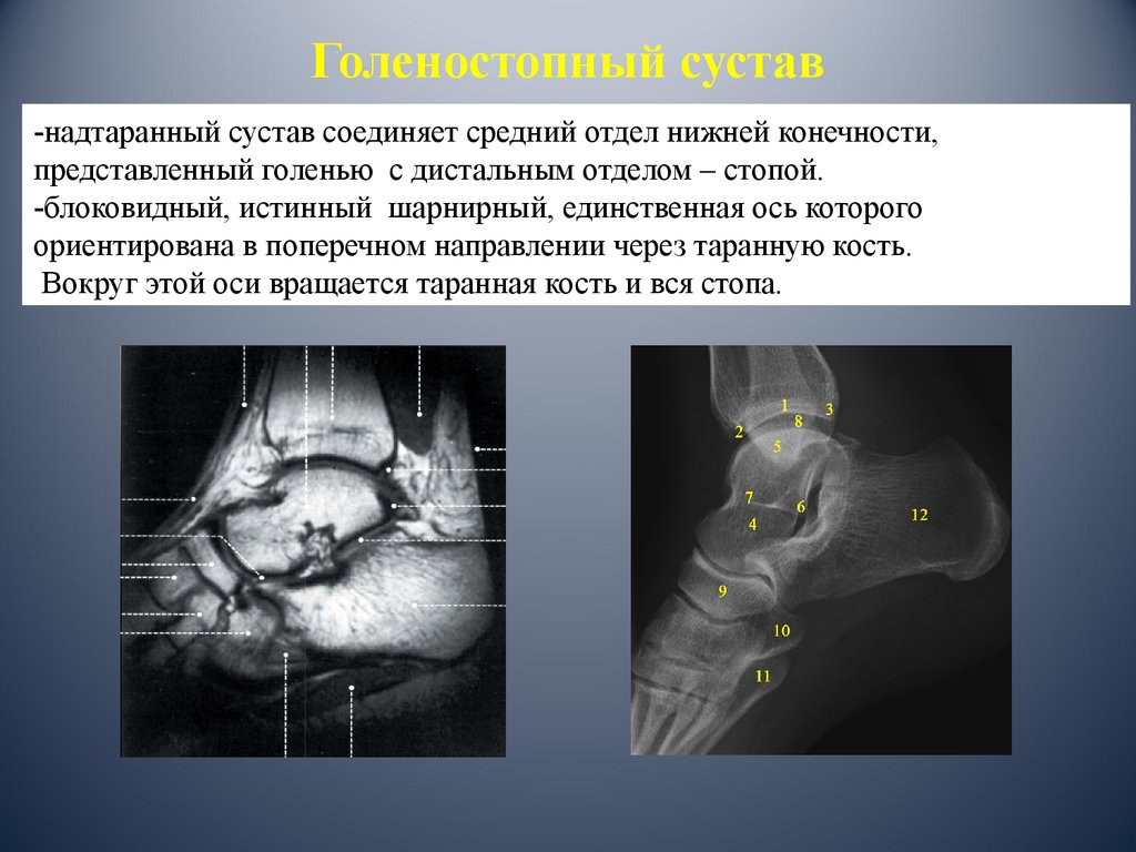 Как делают мрт стопы фото