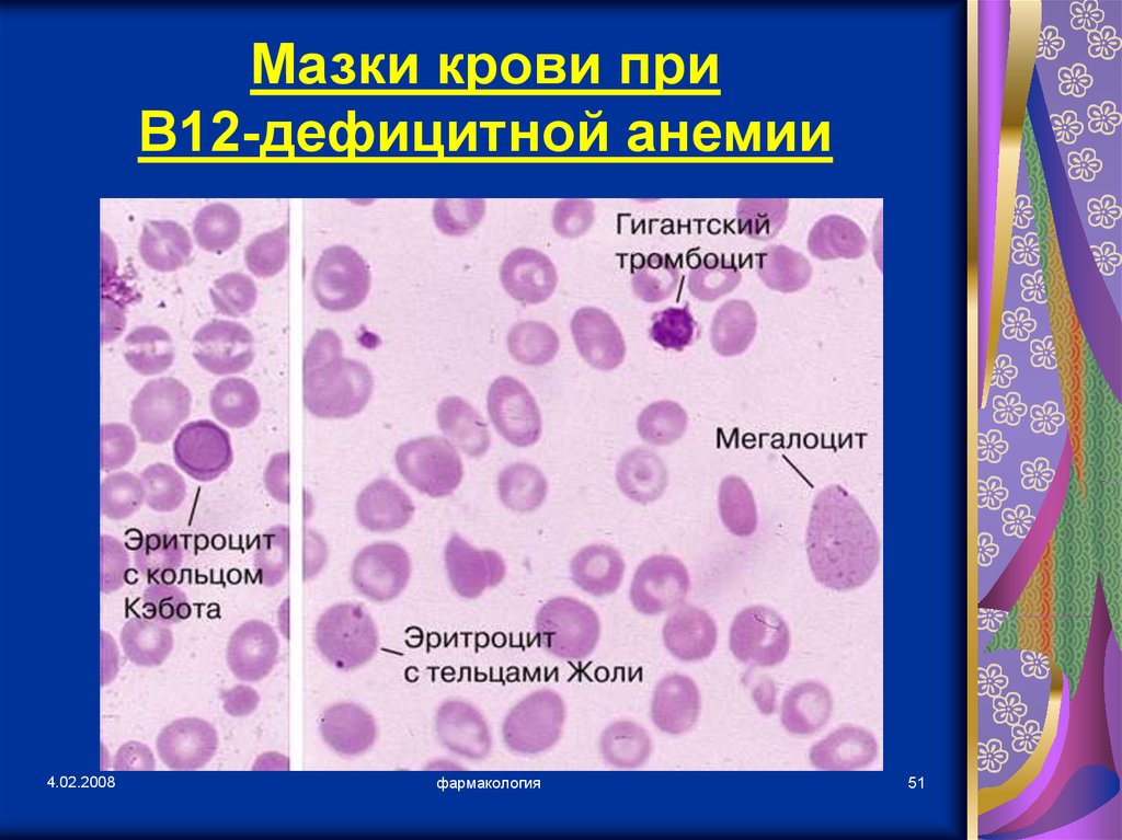 Картина крови при в12 дефицитной анемии периферической