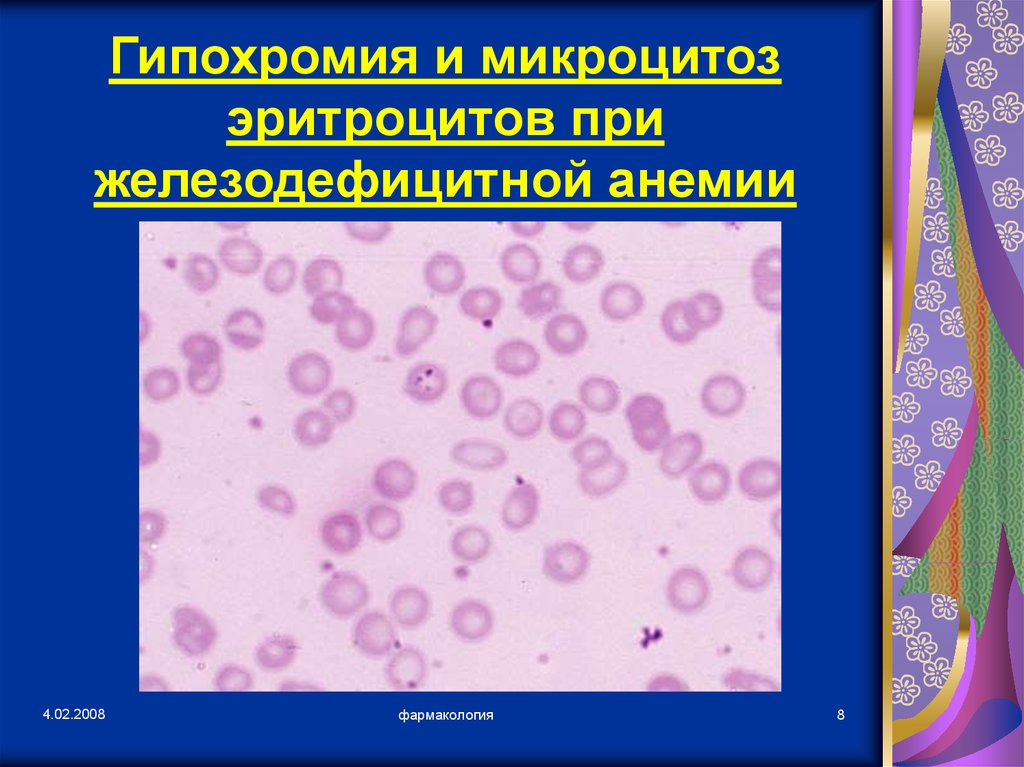 Гипохромия железодефицитная анемия