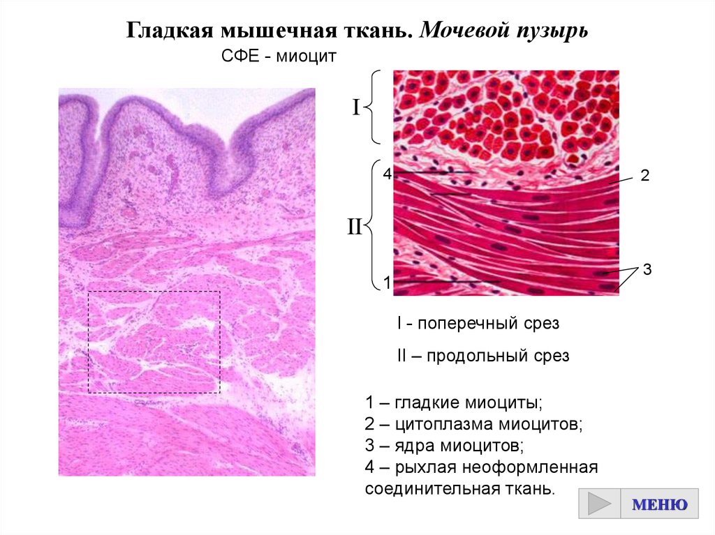 Гладкая ткань. Гладкая мышечная ткань поперечный срез препарат. Гладкая мышечная ткань продольный срез мочевого пузыря. Гладкая мышечная ткань гистология продольный срез. Гладкая мышечная ткань миоцит рыхлая соед ткань.