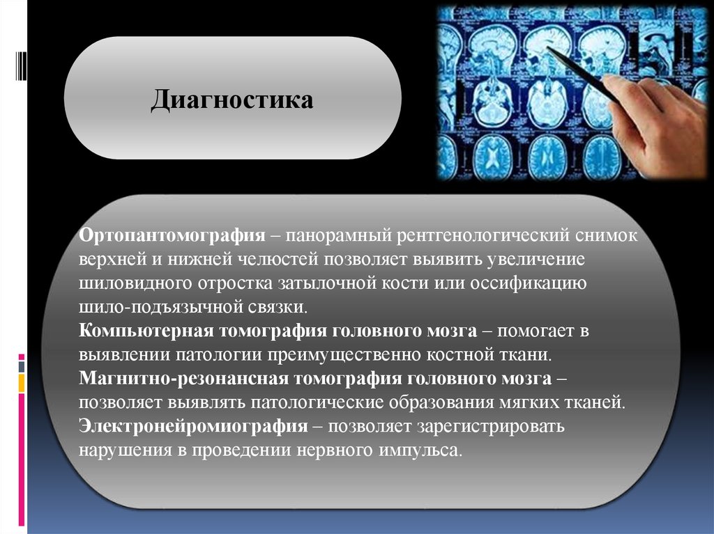 Реферат: Невралгия тройничного нерва. Невралгия языкоглоточного нерва. Постгерпетическая невропатия тройничного нерва