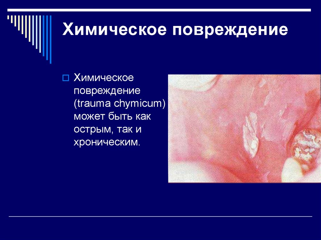 Реферат: Травматические поражения слизистой оболочки рта