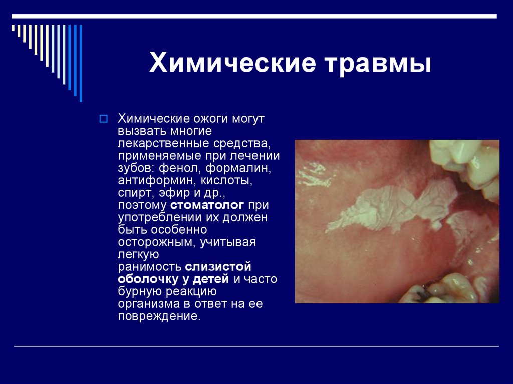 Реферат: Травматические поражения слизистой оболочки рта