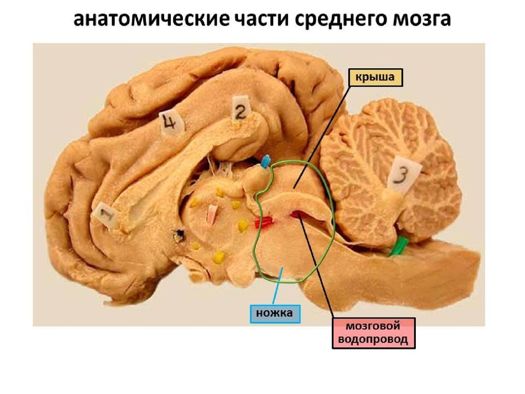 Строение среднего мозга в головном мозге. Крыша среднего мозга (пластинка четверохолмия). Крыша четверохолмия среднего мозга. Водопровод среднего мозга на разрезе среднего мозга. Ножки мозга и пластинка четверохолмия.
