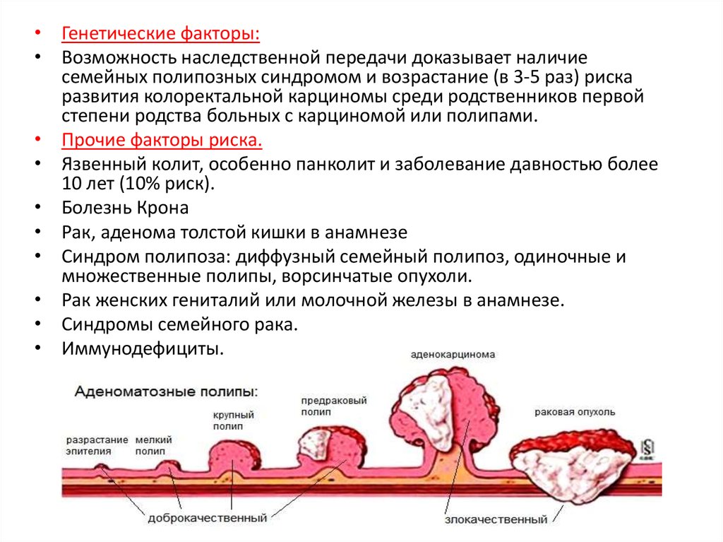 Причины рака прямой кишки