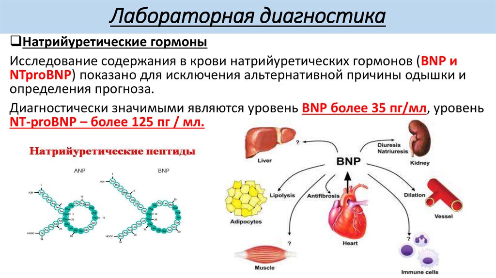 Определение пептида 32 мозга что это. Хроническая сердечная недостаточность натрийуретический пептид. Мозговой натрийуретический пептид (NT-PROBNP) норма. Натрийуретические гормоны при ХСН. Мозговой натрийуретический пептид при ХСН.