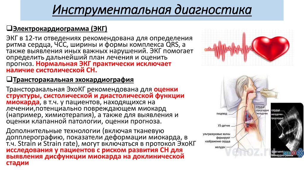 Ибс пропедевтика внутренних болезней презентация