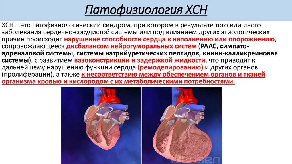 Недостаточность кровообращения болезни. Механизм развития острой сердечной недостаточности патофизиология. Этиология хронической сердечной недостаточности. Патофизиология развития сердечной недостаточности. Хроническая систолическая сердечная недостаточность.