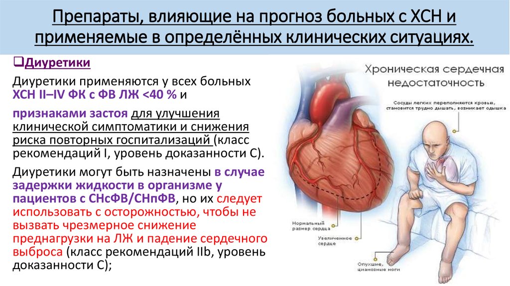 Сердечная недостаточность на фоне алкоголя