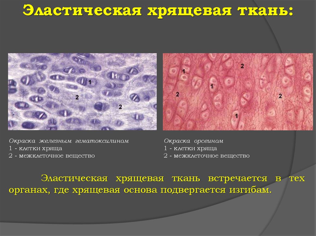 Хрящевая ткань. Эластическая хрящевая ткань (окраска орсеином. Эластическая хрящевая ткань срез ушной раковины окраска орсеином. Окраска орсеином гиалинового хряща. Межклеточное вещество хряща гистология.