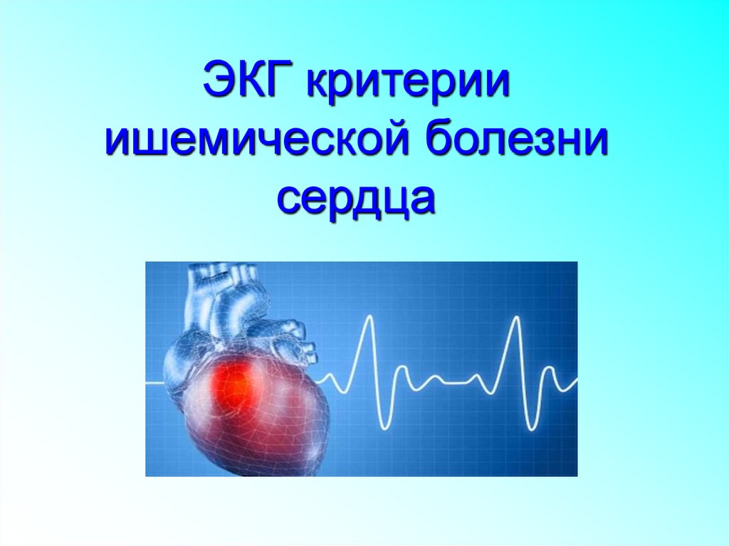 Критерии ишемии. ЭКГ ишемической болезни сердца рисунок. Презентация ЭКГ сердца.