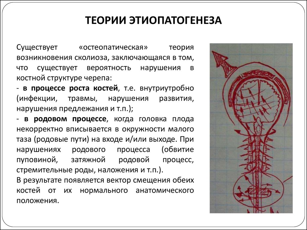 Сколиоз 1 степени группа здоровья