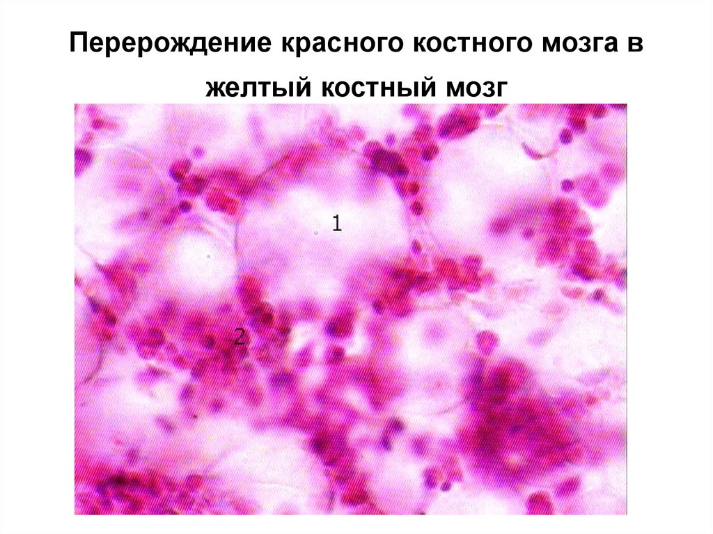 Тимус красный мозг. Красный костный мозг гистология препарат. Миелоидная ткань красного костного мозга. Желтый костный мозг гистология препарат. Красный костный мозг гематоксилин эозин.