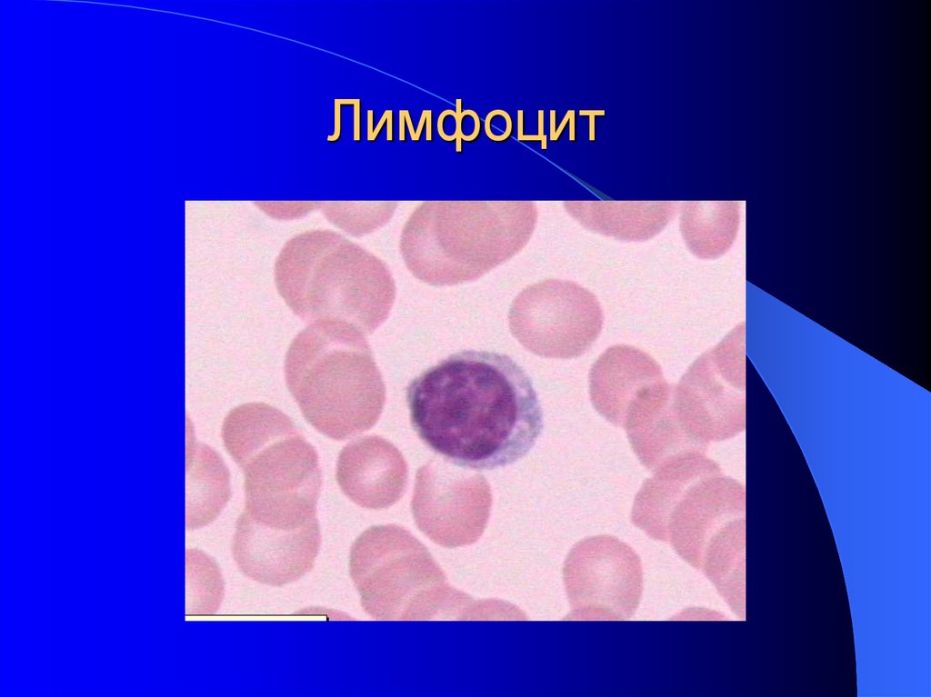 Реактивные лимфоциты в крови. Лимфоциты. B-лимфоциты. Лимфоциты человека. B-лимфоциты рисунок.