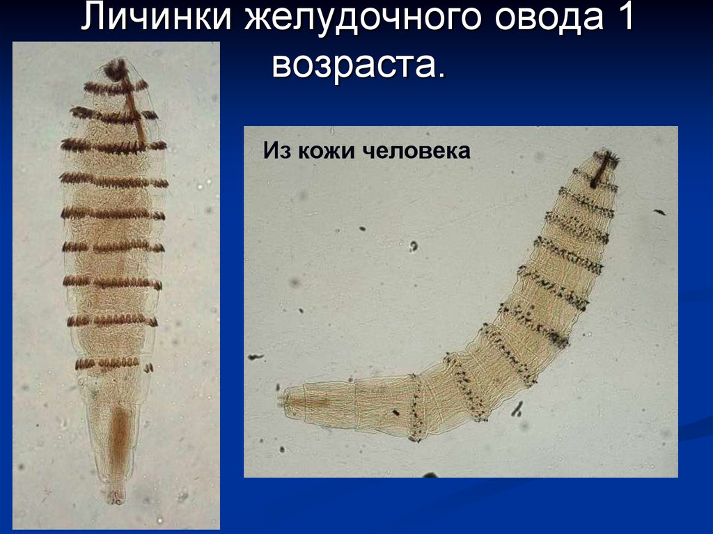 Личинка членистоногих. Личинки желудочного овода. Личинка лошадиного овода. Личинки Оводов в желудке.