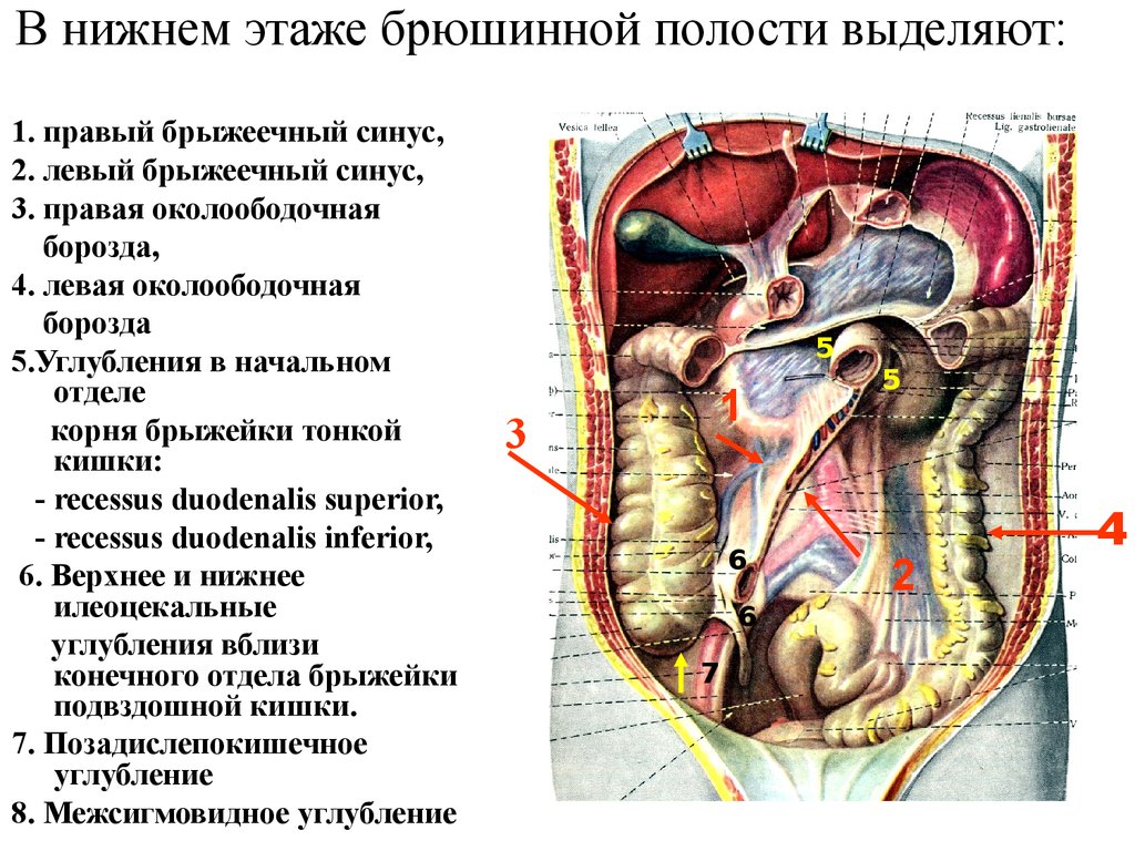 Образование в области живота. Топографическая анатомия органов Нижнего этажа брюшной полости. Карманы брюшины топографическая анатомия. Правый брыжеечный синус брюшины анатомия. Строение брюшины топографическая анатомия.